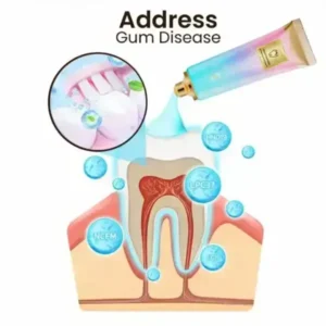 SmileFitPro™ Niacinamide Whitening Toothpaste