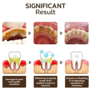 SmileFitPro™ Niacinamide Whitening Toothpaste