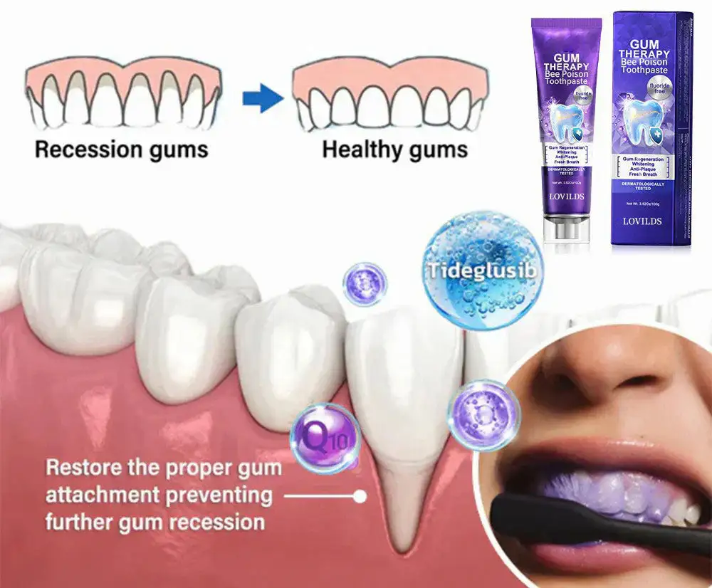 LOVILDS™ Bee Poison Dental Treatment Toothpaste