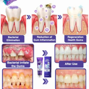 LOVILDS™ Bee Poison Dental Treatment Toothpaste