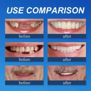 Jakhuors® Premium Denture 2026 | Custom Fit Denture