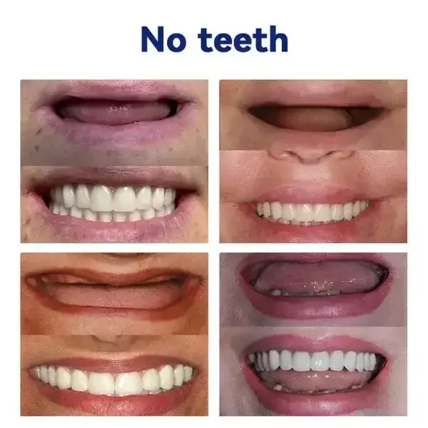 Vaxflite™ Ease Dentures
